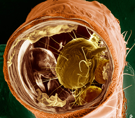 A digital recreation of a tracheal mite inside of a bee. This mite looks like a ball with thin spikes along its body.
